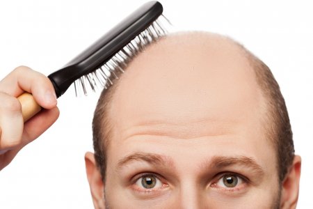 Фото - Врач назвал простые способы предотвратить выпадение волос