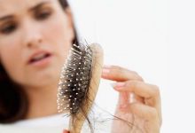 Фото - Врач-биохимик назвала неочевидные причины выпадения волос